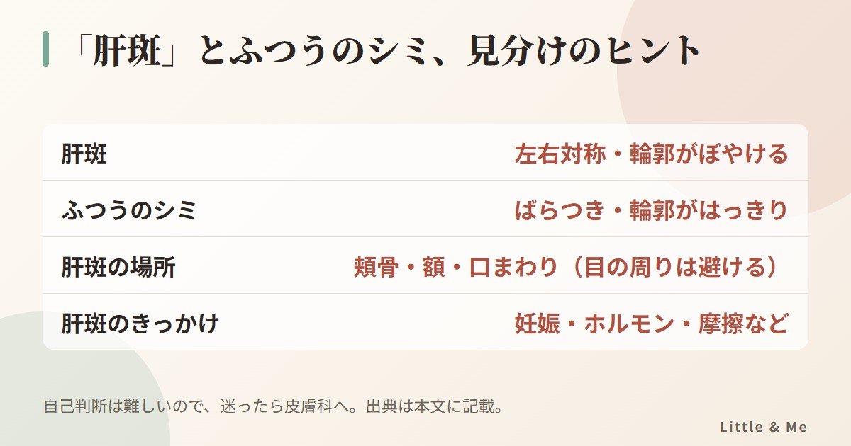 肝斑とふつうのシミの見分けのヒント:肝斑は頬骨・額・口まわりに左右対称で輪郭がぼやけ、目の周りは避ける。ふつうのシミは左右対称でなく輪郭がはっきりしている